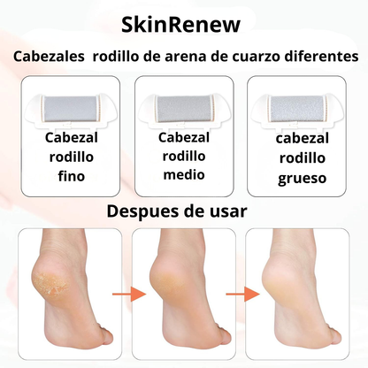 SkinRenew™ Removedor de Callos